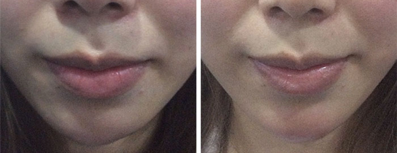 подбородок