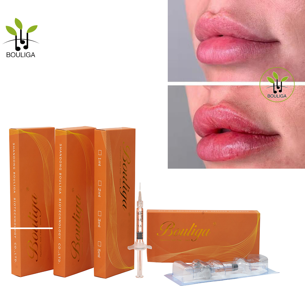 Филлер для губ Gorgeous Lips Filler от Bouliga 1мл 2мл 5мл 10мл