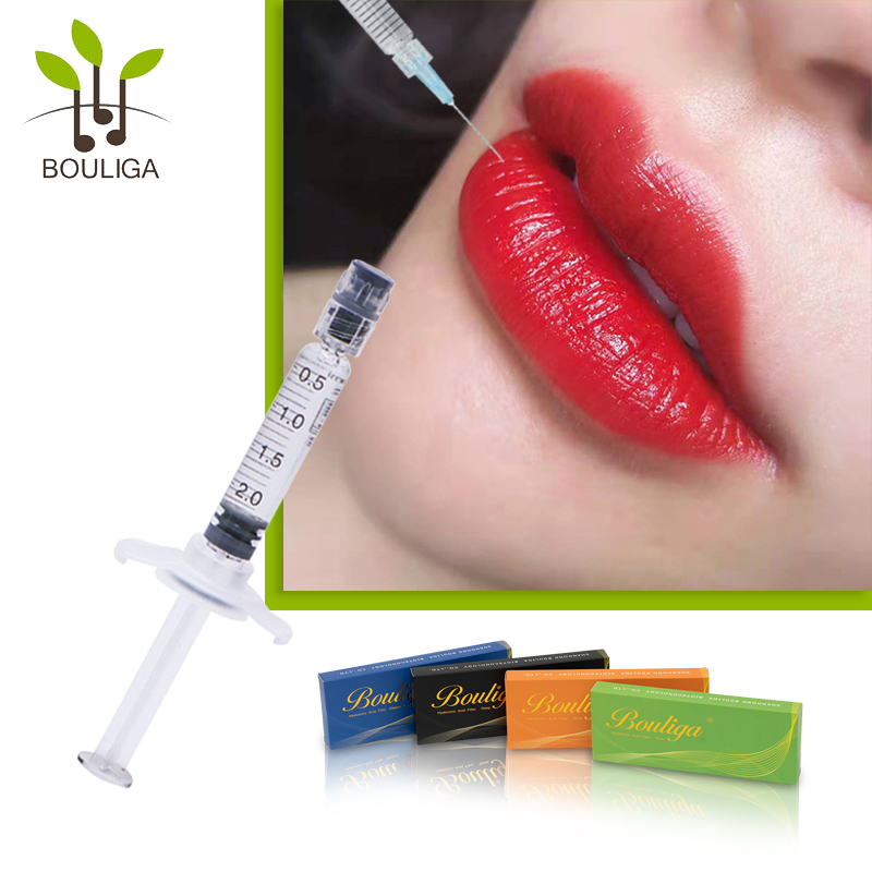 Филлер для губ Gorgeous Lips Filler от Bouliga 1мл 2мл 5мл 10мл